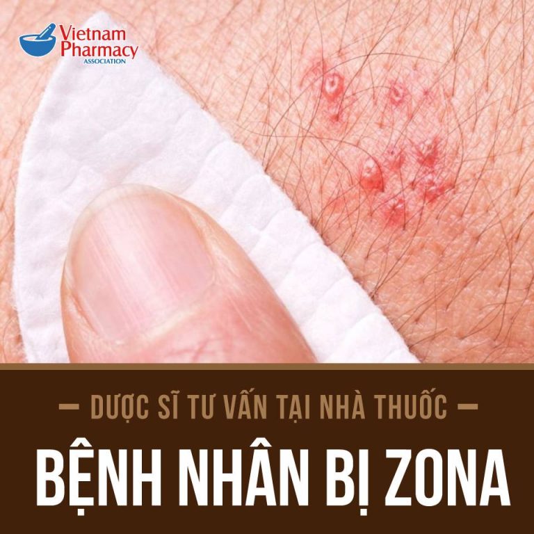 bệnh nhân bị zona