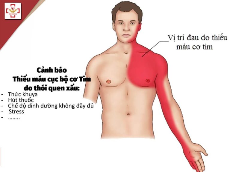 thiếu máu cục bộ cơ tim