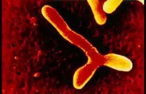 Bifidobacterium