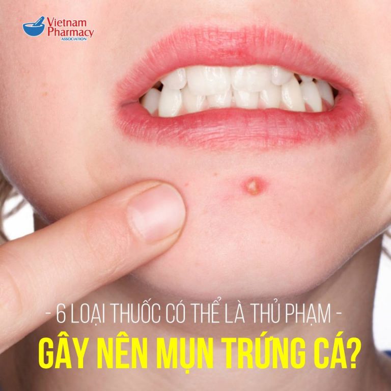 thuốc gây mụn trứng cá