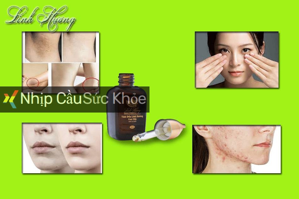 Tinh dầu trị thâm Linh Hương