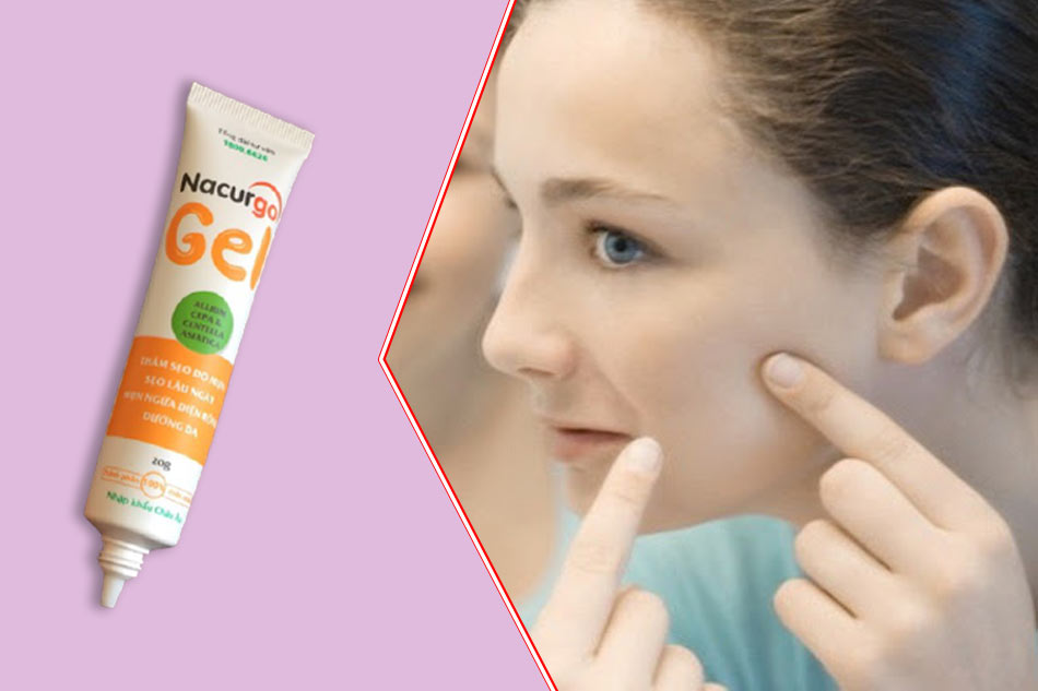 Đối tượng sử dụng gel trị sẹo rỗ, mụn ẩn Nacurgo gel